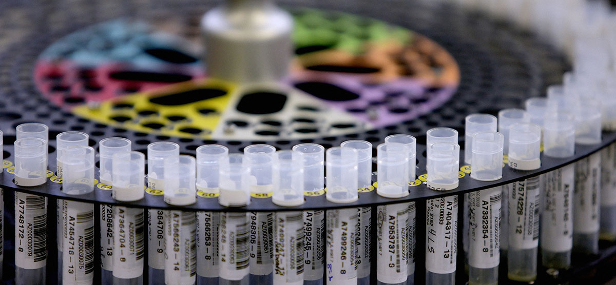 Scientific equipment used in cancer research